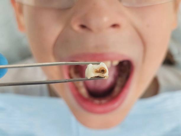 Best Same-Day Emergency Dental Services in Tokeneke, CT